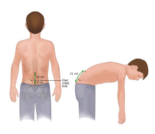 Modifiye Schober Testi