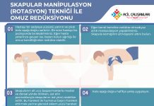 Skapular Manipulasyon (Rotasyon) Tekniği İle Omuz Redüksiyonu