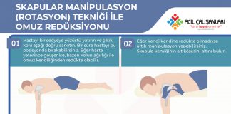Skapular Manipulasyon (Rotasyon) Tekniği İle Omuz Redüksiyonu