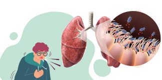 Boğmaca Hastalığı Acil Servis Yaklaşımı