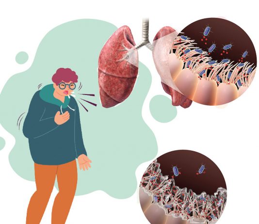 Boğmaca Hastalığı Acil Servis Yaklaşımı