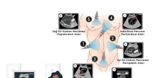 FAST / E-FAST Protokolü