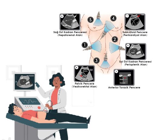 FAST / E-FAST Protokolü