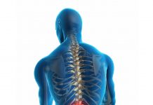 Lumbosakral Grafi Değerlendirme