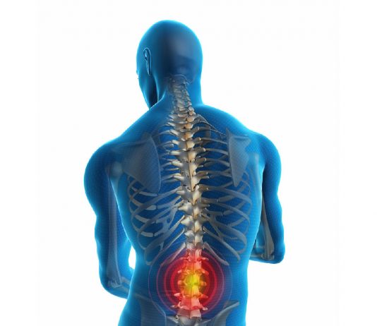 Lumbosakral Grafi Değerlendirme