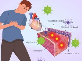 Miyokardit Acil Yaklaşım