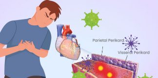 Miyokardit Acil Yaklaşım