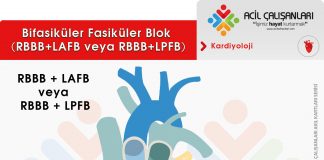 Bifasiküler Blok