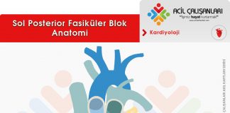 Sol Posterior Fasiküler Blok (LPFB)