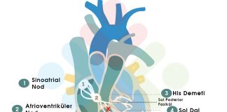 Sol Anterior Fasiküler Blok (LAFB)