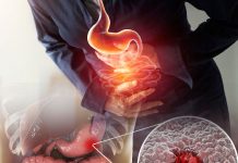 Peptik Ülser Hastalığı