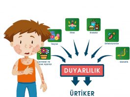Ürtiker Acil Yaklaşım