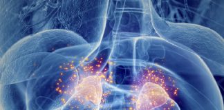 Adrenal Kriz Acil Servis Yönetimi