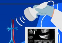 Santral Venöz Basınç Tahmininde İnferior Vena Cava Çapının Sonografik Ölçümü