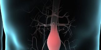 Abdominal Aort Anevrizmasına Acil Yaklaşım