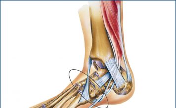 Lisfranc Yaralanması