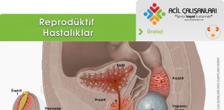 Erkek Ürogenital Enfeksiyonları Akıl Kartı