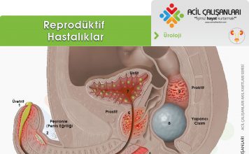 Erkek Ürogenital Enfeksiyonları Akıl Kartı