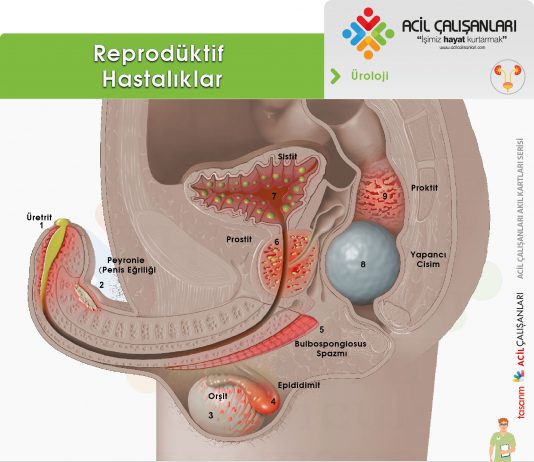 Erkek Ürogenital Enfeksiyonları Akıl Kartı