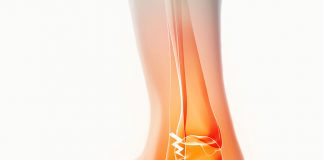 Ayak Bileği Malleol Kırıkları Acil Yaklaşımı