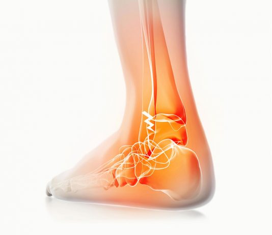 Ayak Bileği Malleol Kırıkları Acil Yaklaşımı