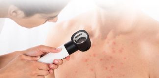 Folikülit Acil Yaklaşım