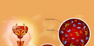Prostatit Acil Yaklaşım