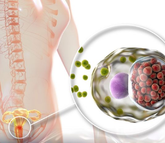 Klamidya Hastalığı