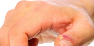 Paronişi (Dolama) Acil Yaklaşım