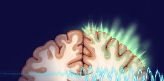 Yetişkinlerde Status Epileptikus Acil Yaklaşım