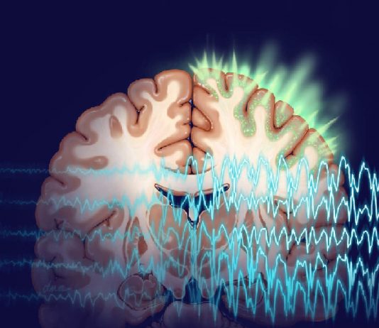 Yetişkinlerde Status Epileptikus Acil Yaklaşım