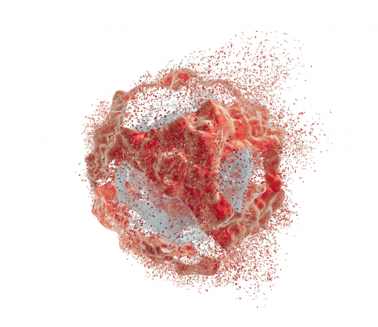 Tümör Lizis Sendromu