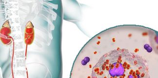 Üretrit Acil Yaklaşım