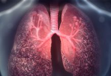 İnterstisyel Akciğer Hastalıkları