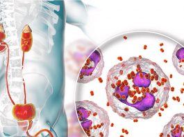 Gonore Hastalığı (Bel Soğukluğu)