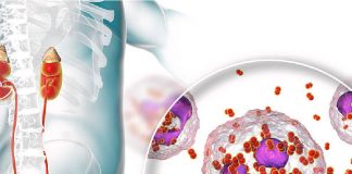 Gonore Hastalığı (Bel Soğukluğu)