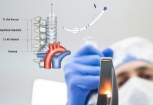 Entübasyonda Endotrakeal Tüpün Yerleşim Doğruluğu ve Derinliği