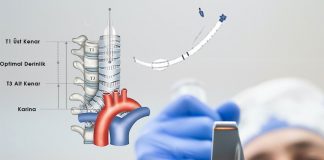 Entübasyonda Endotrakeal Tüpün Yerleşim Doğruluğu ve Derinliği