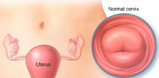 Servisit Acil Yaklaşım