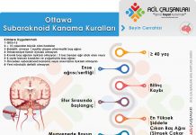 Ottawa Subaraknoid Kanama (SAK) Kuralları