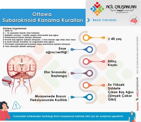 Ottawa Subaraknoid Kanama (SAK) Kuralları