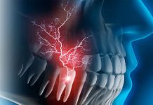 Diş Enfeksiyonları (Diş Ağrısı)