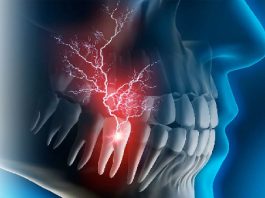 Diş Enfeksiyonları (Diş Ağrısı)