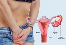 Pelvik İnflamatuvar Hastalık (PID) Acil Yaklaşım