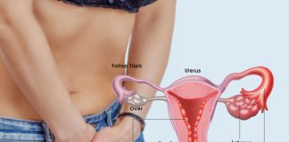 Pelvik İnflamatuvar Hastalık (PID) Acil Yaklaşım