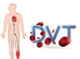 Derin Ven Trombozu (DVT) Acil Yaklaşım
