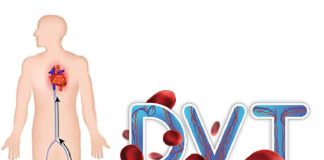Derin Ven Trombozu (DVT) Acil Yaklaşım