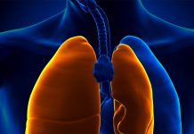 Spontan Pnömotoraks