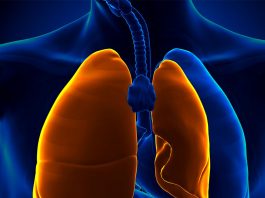 Spontan Pnömotoraks