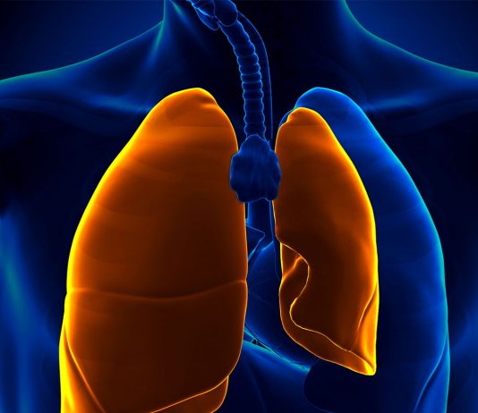 Spontan Pnömotoraks